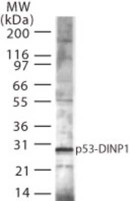Western Blot: p53 DINP1 Antibody [NB100-56627]