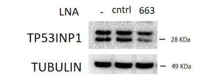 Western Blot: p53 DINP1 AntibodyBSA Free [NBP1-76638]