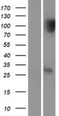 Western Blot: p53 DINP1 Overexpression Lysate [NBP2-05894]