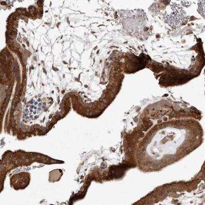 Immunohistochemistry-Paraffin: p53R2 Antibody [NBP1-87368]
