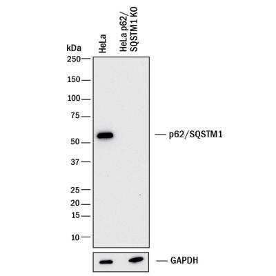Knockout Validated: p62/SQSTM1 Antibody (2533B) - BSA Free [NBP2-92995]