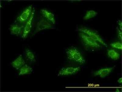 Immunocytochemistry/ Immunofluorescence: p62/SQSTM1 Antibody (2C11) [H00008878-M01]