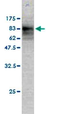 Western Blot: p62/SQSTM1 Antibody (2C11) [H00008878-M01]