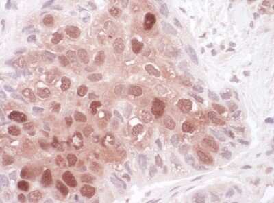 Immunohistochemistry-Paraffin: p62/SQSTM1 Antibody [NBP1-49955]