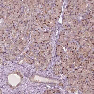 Immunohistochemistry: p62/SQSTM1 Antibody [NBP2-68875]