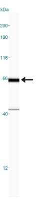 Simple Western: p62/SQSTM1 AntibodyBSA Free [NBP1-42822]
