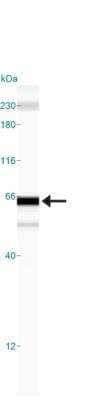 Simple Western: p62/SQSTM1 AntibodyBSA Free [NBP1-48320]