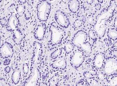 Immunohistochemistry-Paraffin: p63/TP73L Antibody (143) [NBP2-89212]