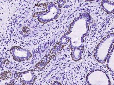 Immunohistochemistry-Paraffin: p63/TP73L Antibody (143) [NBP2-89212]