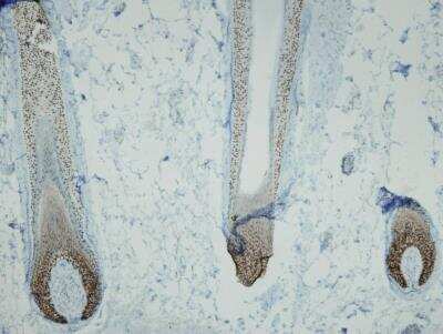 Immunohistochemistry-Paraffin: p63/TP73L Antibody (I27-I) [NBP3-08205]