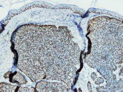 Immunohistochemistry-Paraffin: p63/TP73L Antibody (I27-I) [NBP3-08205]