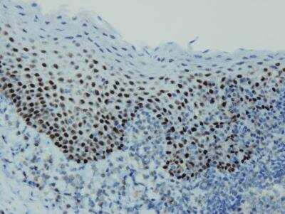 Immunohistochemistry-Paraffin: p63/TP73L Antibody (I27-I) [NBP3-08205]