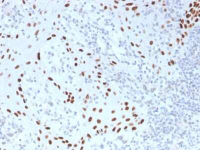 Immunohistochemistry-Paraffin: p63/TP73L Antibody (TP40/3980R) - Azide and BSA Free [NBP3-08775]