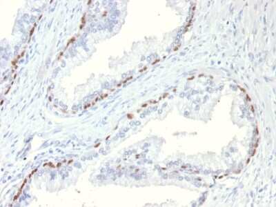 Immunohistochemistry-Paraffin: p63/TP73L Antibody (TP63/11) [NBP3-07431]