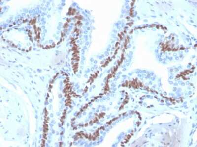 Immunohistochemistry-Paraffin: p63/TP73L Antibody (ZR8) - Azide and BSA Free [NBP3-08776]
