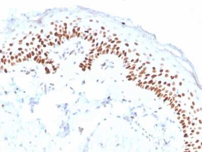 Immunohistochemistry-Paraffin: p63/TP73L Antibody (ZR8) - Azide and BSA Free [NBP3-08776]