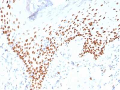 Immunohistochemistry-Paraffin: p63/TP73L Antibody (rTP40/3690) [NBP3-07430]