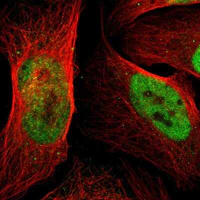 Immunocytochemistry/ Immunofluorescence: p66 alpha Antibody [NBP1-87359]