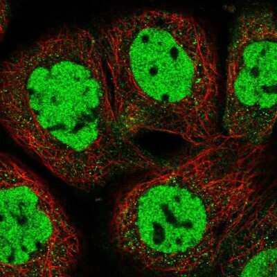 Immunocytochemistry/ Immunofluorescence: p66 alpha Antibody [NBP1-87360]