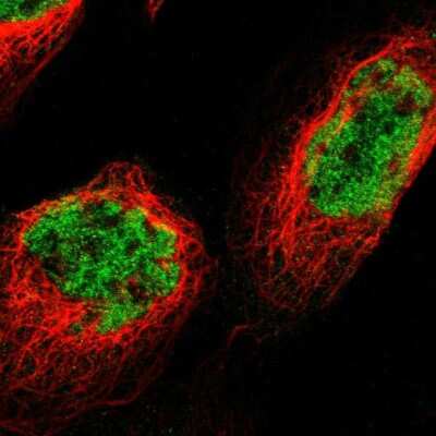 Immunocytochemistry/ Immunofluorescence: p66 beta Antibody [NBP1-87358]