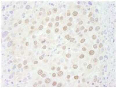 Immunohistochemistry-Paraffin: p66 beta Antibody [NB100-60646]