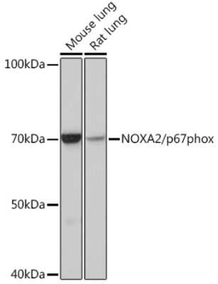 Western Blot: p67phox/NOXA2 Antibody (7J7N3) [NBP3-16257]