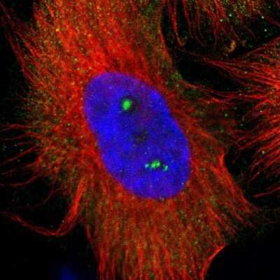 Immunocytochemistry/ Immunofluorescence: p67phox/NOXA2 Antibody [NBP1-82542]