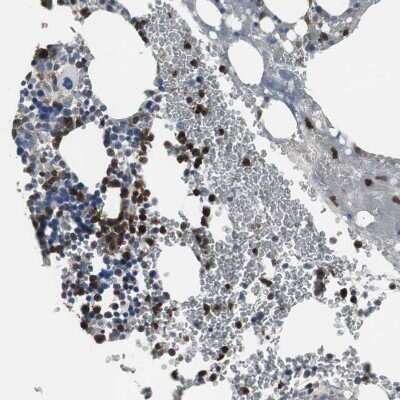 Immunohistochemistry-Paraffin: p67phox/NOXA2 Antibody [NBP1-82542]