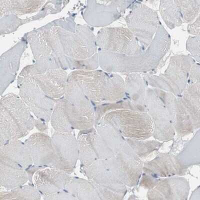 Immunohistochemistry-Paraffin: p67phox/NOXA2 Antibody [NBP1-82542]