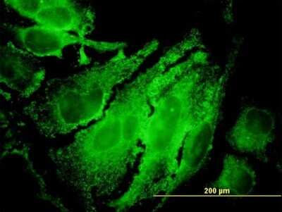 Immunocytochemistry/ Immunofluorescence: p70 S6 Kinase/S6K Antibody (4H4) [H00006198-M04]
