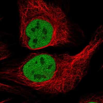 Immunocytochemistry/ Immunofluorescence: p70 S6 Kinase/S6K Antibody [NBP2-38448]