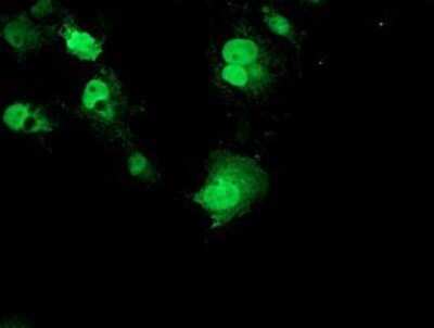 Immunocytochemistry/ Immunofluorescence: p70 S6 Kinase/S6K Antibody (OTI1G4) - Azide and BSA Free [NBP2-73209]