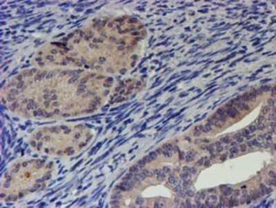 Immunohistochemistry: p70 S6 Kinase/S6K Antibody (OTI1G4) - Azide and BSA Free [NBP2-73209]