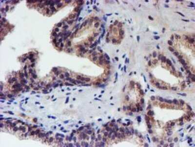 Immunohistochemistry: p70 S6 Kinase/S6K Antibody (OTI1G4) - Azide and BSA Free [NBP2-73209]