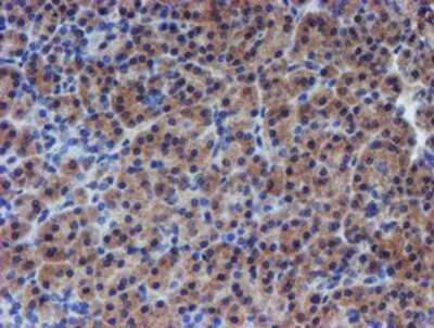 Immunohistochemistry: p70 S6 Kinase/S6K Antibody (OTI1G4) - Azide and BSA Free [NBP2-73209]