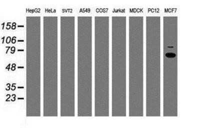 Western Blot: p70 S6 Kinase/S6K Antibody (OTI1G4)Azide and BSA Free [NBP2-73209]