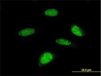 Immunocytochemistry/ Immunofluorescence: p70 S6 Kinase beta/S6K2 Antibody (4B11) [H00006199-M08]