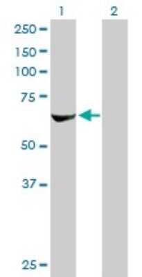Western Blot: p70 S6 Kinase beta/S6K2 Antibody (4B11) [H00006199-M08]