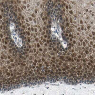 Immunohistochemistry-Paraffin: p70 S6 Kinase beta/S6K2 Antibody [NBP1-87805]