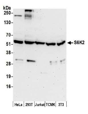 Western Blot: p70 S6 Kinase beta/S6K2 Antibody [NB100-1545]