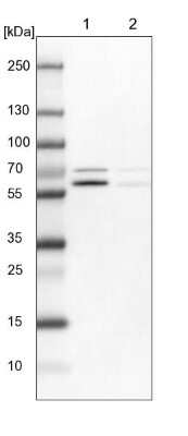 Western Blot: p70 S6 Kinase beta/S6K2 Antibody [NBP1-87805]