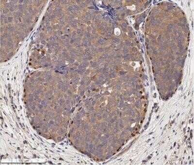 Immunocytochemistry: p73 Antibody (5B1288) - Azide Free [NBP2-33241]
