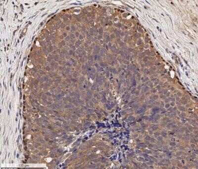 Immunohistochemistry-Paraffin: p73 Antibody (5B1288) - Azide Free [NBP2-33241]