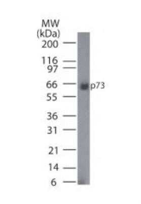 Western Blot: p73 Antibody (5B1288)Azide Free [NBP2-33241]