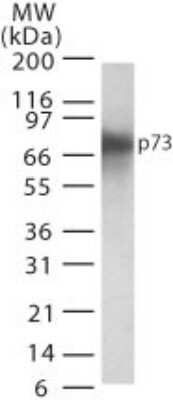 Western Blot: p73 Antibody (5B1288)BSA Free [NB100-56674]