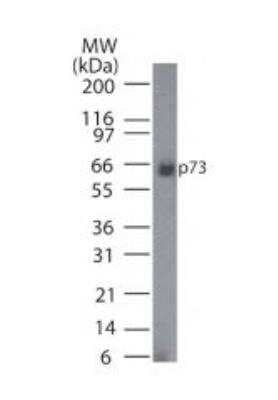 Western Blot: p73 Antibody (5B1288)BSA Free [NB100-56674]