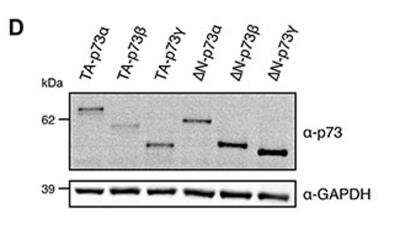 Western Blot: p73 Antibody (5B1288)BSA Free [NB100-56674]
