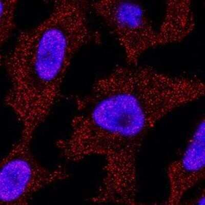 Immunocytochemistry/ Immunofluorescence: p73 Antibody (5B429) - Azide Free [NBP2-33259]