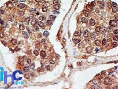 Immunohistochemistry-Paraffin: p73 Antibody (5B429) - Azide Free [NBP2-33259]