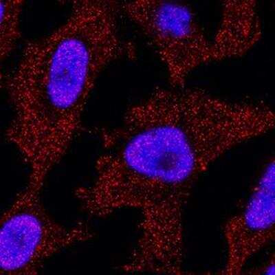 Immunocytochemistry/ Immunofluorescence: p73 Antibody (5B429) - BSA Free [NBP2-24737]